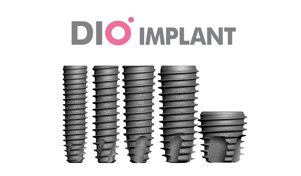 Dio Implant